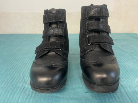 Piede di Charcot: calzature definitive
